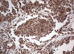 PIK3CA Monoclonal Antibody (OTI6D9), TrueMAB , OriGene 100 &mu;L; Unconjugated:Antibodies,