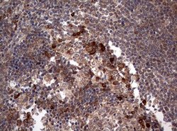PIK3CA Monoclonal Antibody (OTI6D9), TrueMAB , OriGene 100 &mu;L; Unconjugated:Antibodies,
