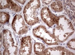 PIK3CA Monoclonal Antibody (OTI6D9), TrueMAB , OriGene 100 &mu;L; Unconjugated:Antibodies,