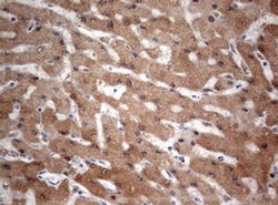 PIK3CA Monoclonal Antibody (OTI6D9), TrueMAB , OriGene 100 &mu;L; Unconjugated:Antibodies,