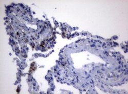 PIK3CD Monoclonal Antibody (OTI1B5), TrueMAB , OriGene 100 &mu;L; Unconjugated:Antibodies,