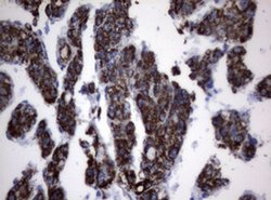 PIK3CD Monoclonal Antibody (OTI1B5), TrueMAB , OriGene 100 &mu;L; Unconjugated:Antibodies,