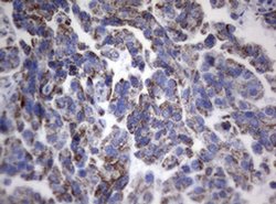 PIK3CD Monoclonal Antibody (OTI1B5), TrueMAB , OriGene 100 &mu;L; Unconjugated:Antibodies,
