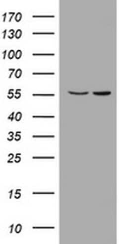 PIK3CD Monoclonal Antibody (OTI1B5), TrueMAB , OriGene 100 &mu;L; Unconjugated:Antibodies,