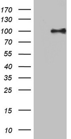 PIK3CD Mouse anti-Human, Clone: OTI1F8, lyophilized, TrueMAB 100 &mu;g;