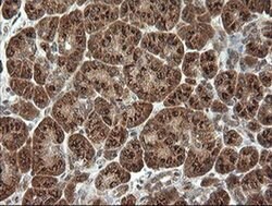 PIK3CG Mouse anti-Human, Clone: OTI2B1, liquid, TrueMAB 100 &mu;L; Unconjugated:Antibodies,