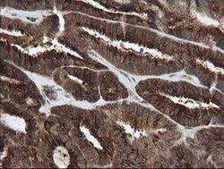PIK3CG Mouse anti-Human, Clone: OTI2B1, liquid, TrueMAB 100 &mu;L; Unconjugated:Antibodies,