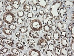 PIK3CG Mouse anti-Human, Clone: OTI2B1, liquid, TrueMAB 100 &mu;L; Unconjugated:Antibodies,