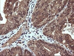 PIK3CG Monoclonal Antibody (OTI6D1), TrueMAB , OriGene 100 &mu;L; Unconjugated:Antibodies,