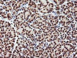 PIK3CG Monoclonal Antibody (OTI6D1), TrueMAB , OriGene 100 &mu;L; Unconjugated:Antibodies,