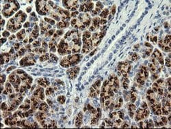 PIK3CG Monoclonal Antibody (OTI6C6), TrueMAB , OriGene 30 &mu;L; Unconjugated:Antibodies,