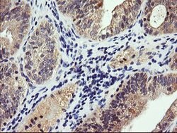 PIK3CG Mouse anti-Human, Clone: OTI4G10, lyophilized, TrueMAB 100 &mu;g;