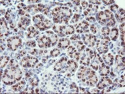 PIK3CG Mouse anti-Human, Clone: OTI4G10, lyophilized, TrueMAB 100 &mu;g;
