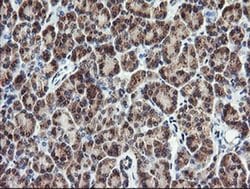 PIK3CG Mouse anti-Human, Mouse, Clone: OTI6H5, liquid, TrueMAB 30 &mu;L;