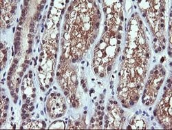 PIK3CG Mouse anti-Human, Mouse, Clone: OTI6H5, liquid, TrueMAB 30 &mu;L;