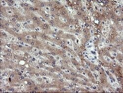 PIK3CG Mouse anti-Human, Mouse, Clone: OTI6H5, liquid, TrueMAB 30 &mu;L;