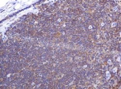 PIK3CG Monoclonal Antibody (OTI4B1), TrueMAB , OriGene 100 &mu;L; Unconjugated:Antibodies,