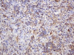 PIK3CG Monoclonal Antibody (OTI4B1), TrueMAB , OriGene 100 &mu;L; Unconjugated:Antibodies,