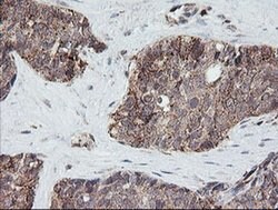 PIK3CG Monoclonal Antibody (OTI4B9), TrueMAB , OriGene 30 &mu;L; Unconjugated:Antibodies,