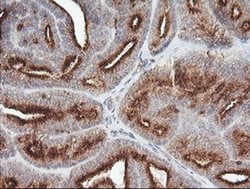 PIK3CG Monoclonal Antibody (OTI4B9), TrueMAB , OriGene 30 &mu;L; Unconjugated:Antibodies,