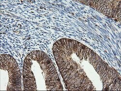 PIK3CG Monoclonal Antibody (OTI4B9), TrueMAB , OriGene:Antibodies:Primary