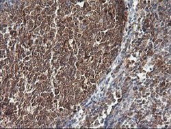PIK3CG Monoclonal Antibody (OTI4B9), TrueMAB , OriGene:Antibodies:Primary