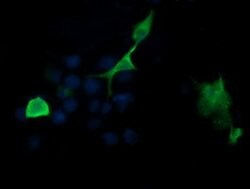 PIK3R5 Mouse anti-Human, Clone: OTI4C12, lyophilized, TrueMAB 100 &mu;g;