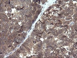 PIK3R5 Monoclonal Antibody (OTI4G9), TrueMAB , OriGene 100 &mu;L; Unconjugated:Antibodies,