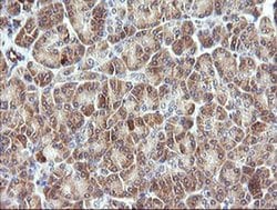 PIK3R5 Monoclonal Antibody (OTI4G9), TrueMAB , OriGene 100 &mu;L; Unconjugated:Antibodies,