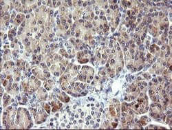 PIK3R5 Monoclonal Antibody (OTI6C5), TrueMAB , OriGene 100 &mu;L; Unconjugated:Antibodies,
