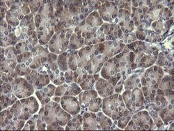 PIK3R5 Monoclonal Antibody (OTI2E4), TrueMAB , OriGene 100 &mu;L; Unconjugated:Antibodies,