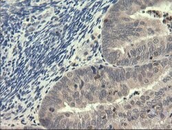 PIK3R5 Monoclonal Antibody (OTI2E4), TrueMAB , OriGene 100 &mu;L; Unconjugated:Antibodies,