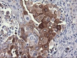PIK3R5 Mouse anti-Human, Clone: OTI4B11, lyophilized, TrueMAB 100 &mu;g;