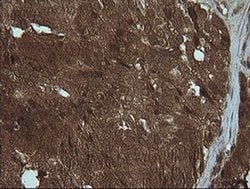 PIK3R5 Monoclonal Antibody (OTI2C6), TrueMAB , OriGene 100 &mu;L; Unconjugated:Antibodies,