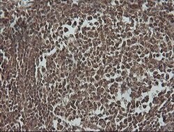PIK3R5 Monoclonal Antibody (OTI2C6), TrueMAB , OriGene 100 &mu;L; Unconjugated:Antibodies,