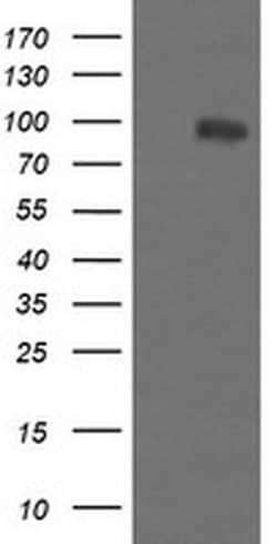 PIK3R5 Monoclonal Antibody (OTI4G9), TrueMAB , OriGene 100 &mu;L; Unconjugated:Antibodies,