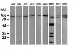 PIK3R5 Monoclonal Antibody (OTI4G9), TrueMAB , OriGene:Antibodies:Primary