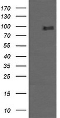 PIK3R5 Monoclonal Antibody (OTI6C5), TrueMAB , OriGene 100 &mu;L; Unconjugated:Antibodies,