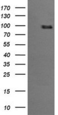 PIK3R5 Mouse anti-Human, Clone: OTI4C12, lyophilized, TrueMAB 100 &mu;g;