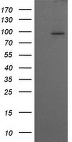 PIK3R5 Monoclonal Antibody (OTI2E4), TrueMAB , OriGene 100 &mu;L; Unconjugated:Antibodies,