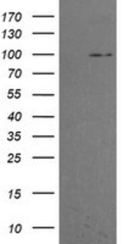PIK3R5 Mouse anti-Human, Clone: OTI4B11, lyophilized, TrueMAB 100 &mu;g;