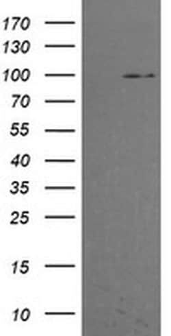 PIK3R5 Monoclonal Antibody (OTI4B11), TrueMAB , OriGene 100 &mu;L; Unconjugated:Antibodies,