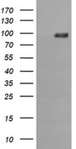 PIK3R5 Monoclonal Antibody (OTI2C6), TrueMAB , OriGene 100 &mu;L; Unconjugated:Antibodies,