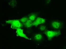 PIM2 Monoclonal Antibody (OTI8H10), TrueMAB , OriGene 30 &mu;L; Unconjugated:Antibodies,