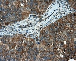 PIM2 Monoclonal Antibody (OTI10A12), TrueMAB , OriGene 30 &mu;L; Unconjugated:Antibodies,