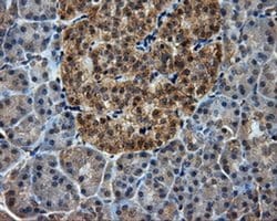 PIM2 Monoclonal Antibody (OTI10A12), TrueMAB , OriGene 30 &mu;L; Unconjugated:Antibodies,