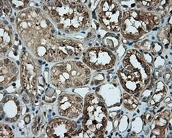 PIM2 Monoclonal Antibody (OTI10A12), TrueMAB , OriGene 30 &mu;L; Unconjugated:Antibodies,