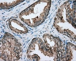PIM2 Monoclonal Antibody (OTI8H10), TrueMAB , OriGene 30 &mu;L; Unconjugated:Antibodies,
