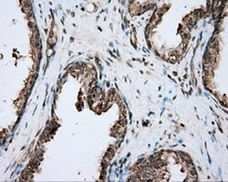 PIM2 Monoclonal Antibody (OTI8H10), TrueMAB , OriGene 30 &mu;L; Unconjugated:Antibodies,