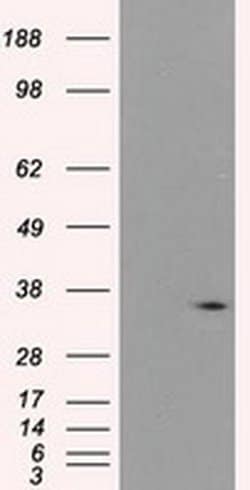 PIM2 Monoclonal Antibody (OTI5B5), TrueMAB , OriGene 30 &mu;L; Unconjugated:Antibodies,